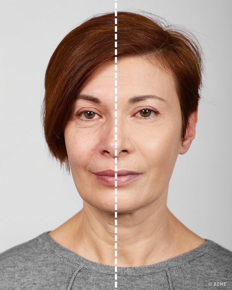 7 хитростей от визажиста, которые помогут выглядеть моложе