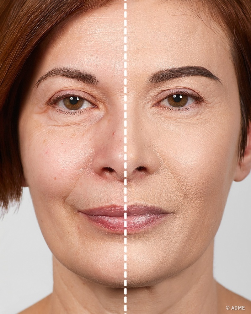 7 хитростей от визажиста, которые помогут выглядеть моложе