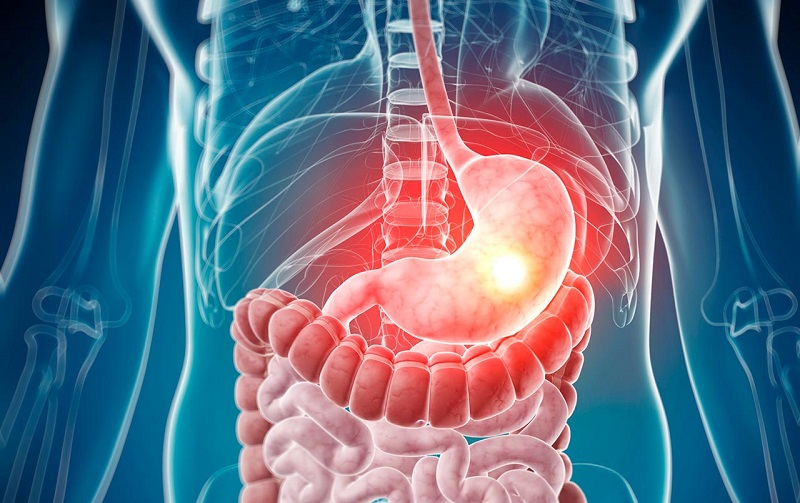 Восстанови микрофлору кишечника: 3 ферментированных продукта, которые избавят от сотни заболеваний.