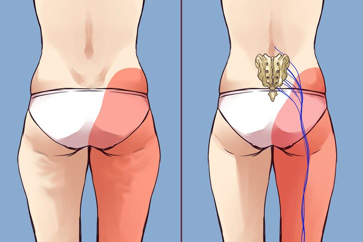 Упражнения, которые спасут от застоя лимфы из-за сидячего образа жизни