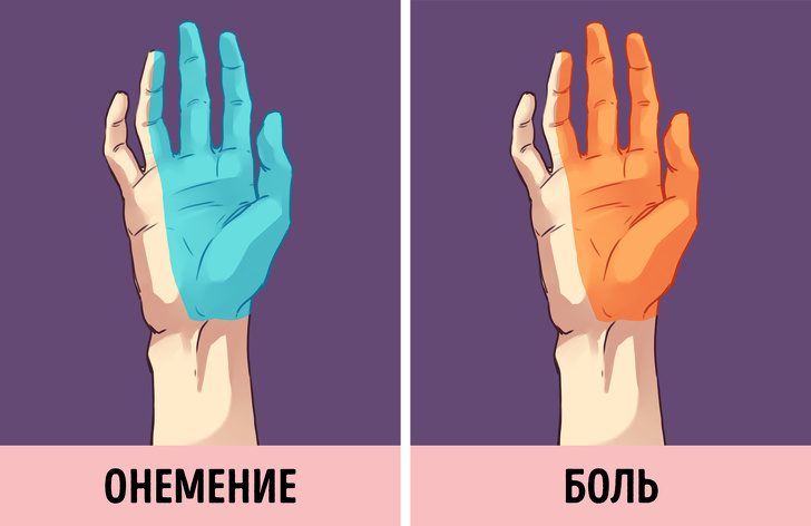 Упражнения, которые спасут от застоя лимфы из-за сидячего образа жизни