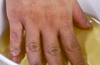 Яблочный уксус избавит вас от этих 10 болезней