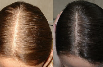 Эти три ингредиента остановят выпадение волос и восстановят их силу и блеск за один раз!