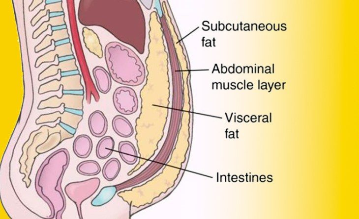 5 случаев, когда живот появляется не от лишнего веса