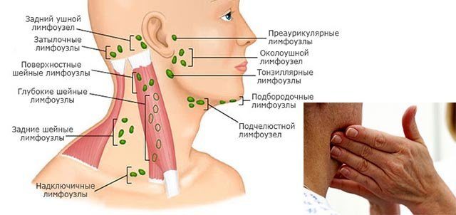 Где на шее находятся лимфоузлы схема